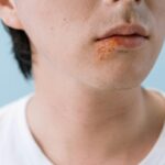 do plantar warts resolve spontaneously